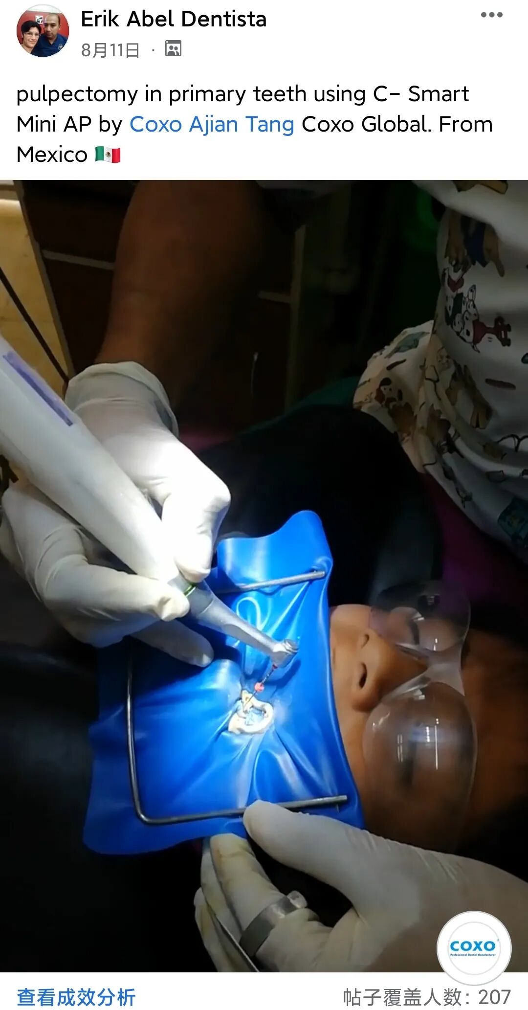 为什么要用根管马达为何选择宇森机扩？他们有料要爆！_https://www.jmylbn.com_新闻资讯_第7张