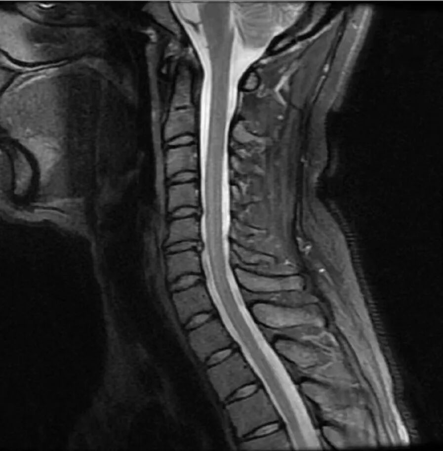 激光理疗有什么作用高能量激光疗法丨理疗技术的里程碑，深度疼痛的希望之光_https://www.jmylbn.com_新闻资讯_第18张