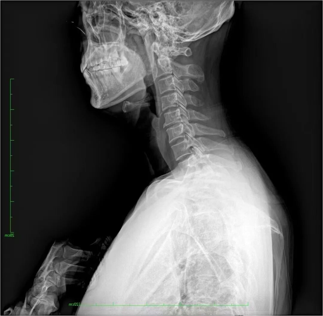 激光理疗有什么作用高能量激光疗法丨理疗技术的里程碑，深度疼痛的希望之光_https://www.jmylbn.com_新闻资讯_第19张