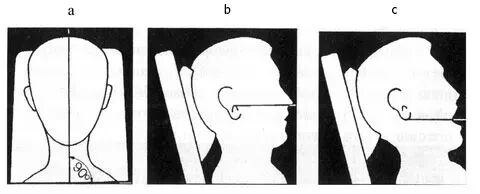 牙片传感器是什么【收藏版】超详细的小牙片拍摄技巧，请转给你身边有需要的牙医和护士哦！_https://www.jmylbn.com_新闻资讯_第2张
