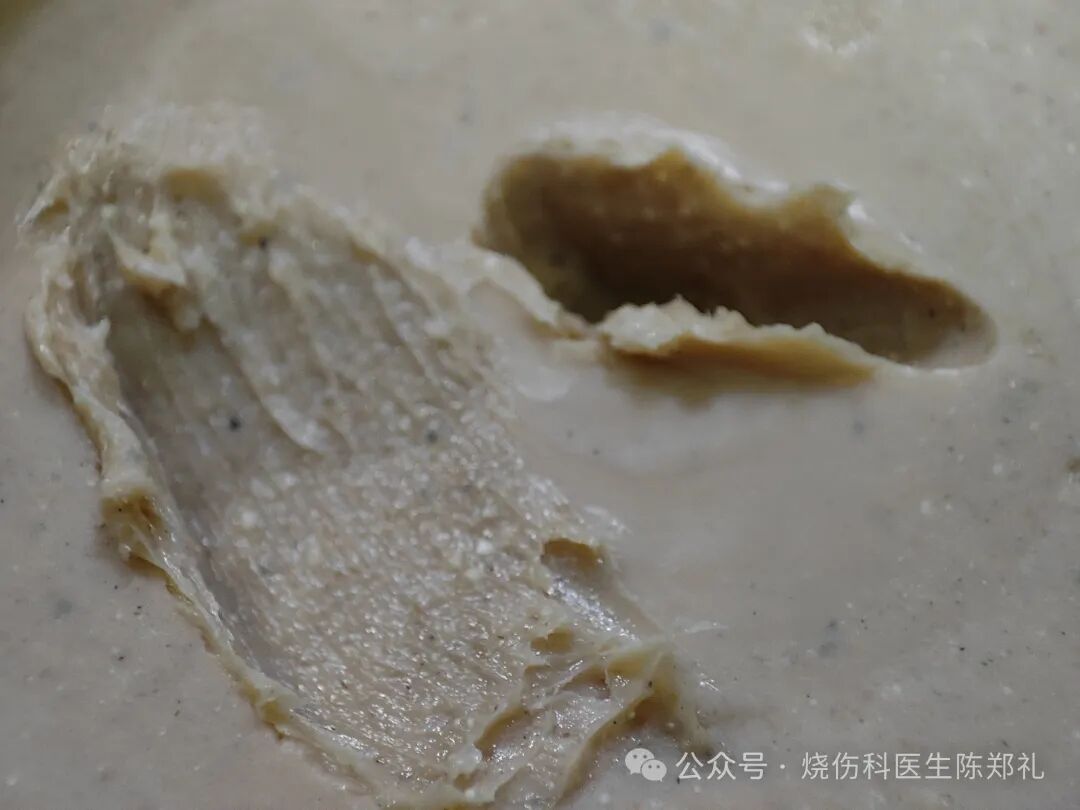 烧伤敷料怎么用图解创面外用药物及敷料系列丨油性药膏的原理及注意事项_https://www.jmylbn.com_新闻资讯_第10张