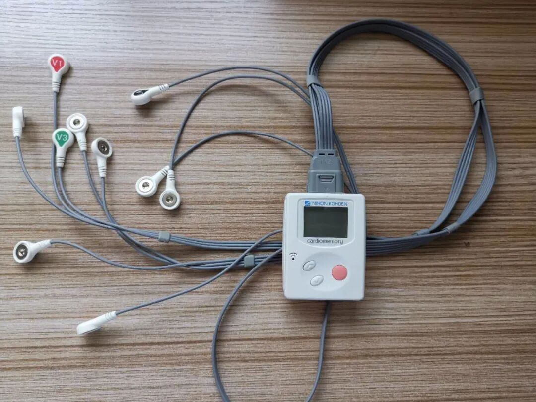 动态心电图自己怎么记录【专家解读】普通心电图和动态心电图哪个好？_https://www.jmylbn.com_新闻资讯_第6张