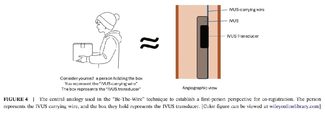 造影导丝是什么如何用“化身导丝”的理念去理解和实现 IVUS-造影配准？_https://www.jmylbn.com_新闻资讯_第9张
