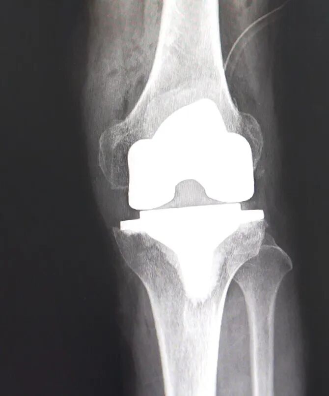 洗牙机器什么牌子好《健康常在》第116期——智慧医疗“黑科技”，机器人频繁现身_https://www.jmylbn.com_新闻资讯_第5张