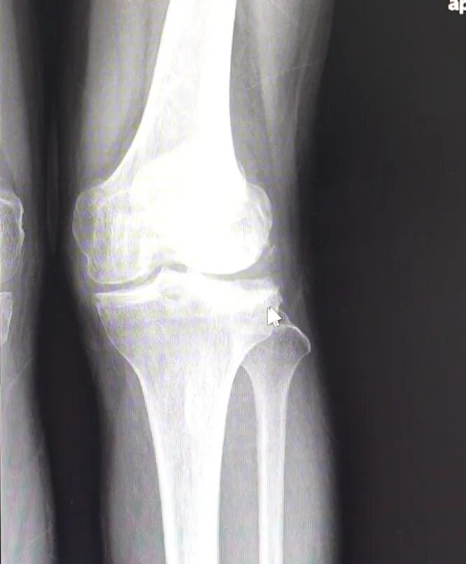 洗牙机器什么牌子好《健康常在》第116期——智慧医疗“黑科技”，机器人频繁现身_https://www.jmylbn.com_新闻资讯_第4张