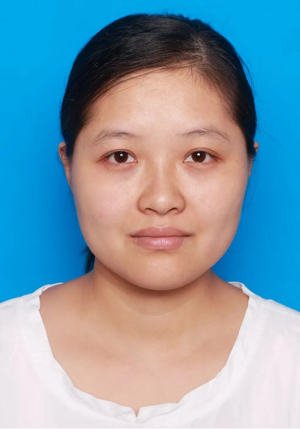 留置胃管鼻贴怎么贴管饲饮食患者居家护理全指南_https://www.jmylbn.com_新闻资讯_第3张