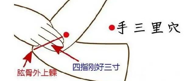 【诊疗】2个小穴位巧治落枕