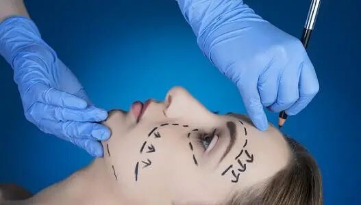 pga和pgla有什么区别贾东宇：什么是面部线雕？有什么优势？丨科普篇_https://www.jmylbn.com_新闻资讯_第5张