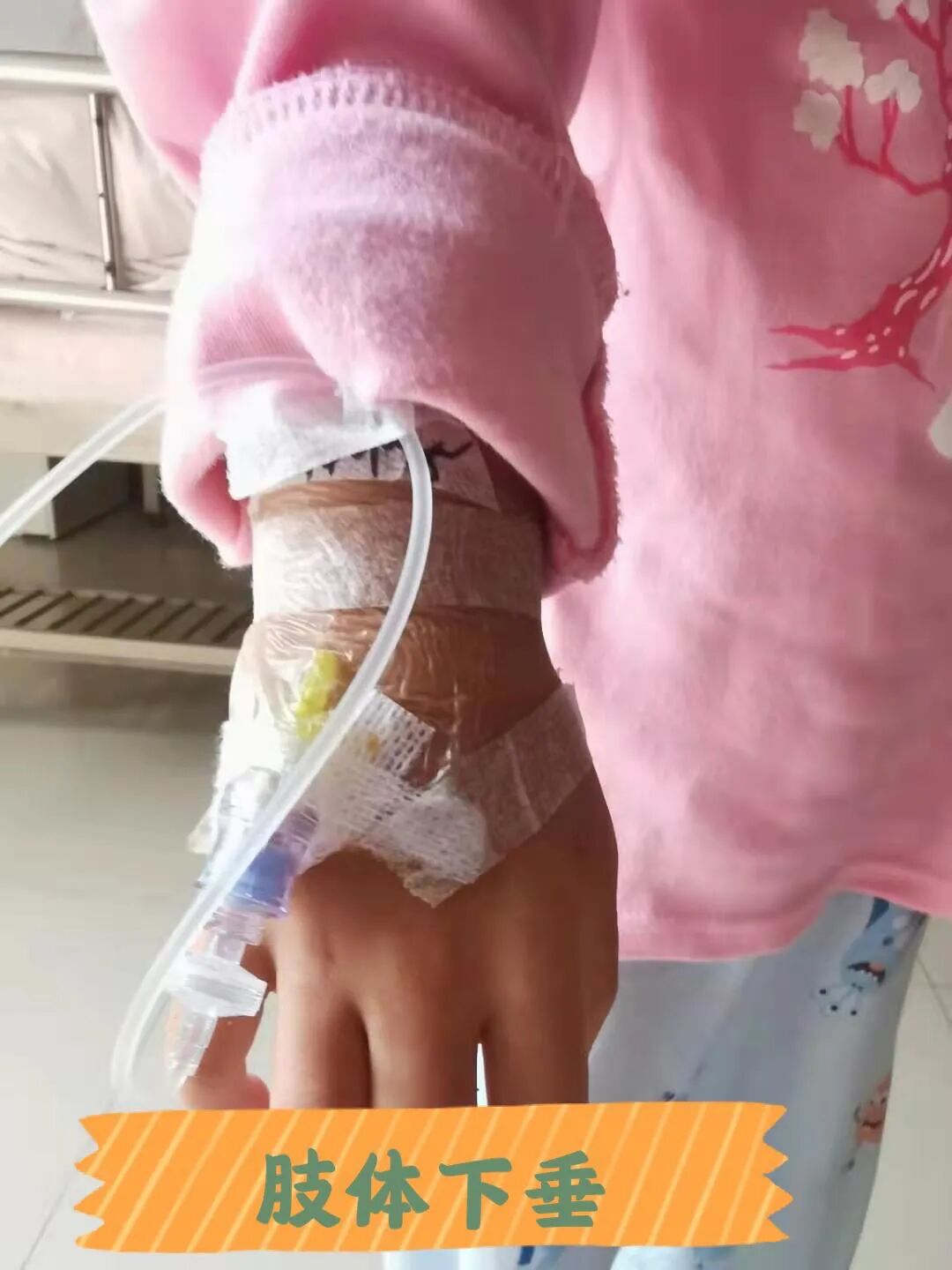 为什么输血不能用小针关于“留置针”的小秘密_https://www.jmylbn.com_新闻资讯_第9张