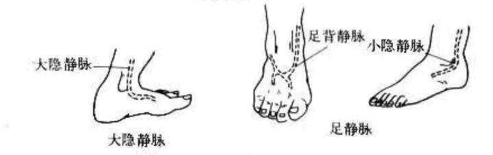 为什么输血不能用小针关于“留置针”的小秘密_https://www.jmylbn.com_新闻资讯_第8张