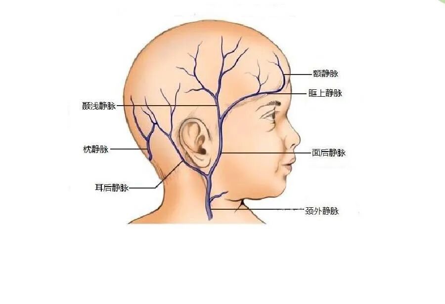 为什么输血不能用小针关于“留置针”的小秘密_https://www.jmylbn.com_新闻资讯_第6张