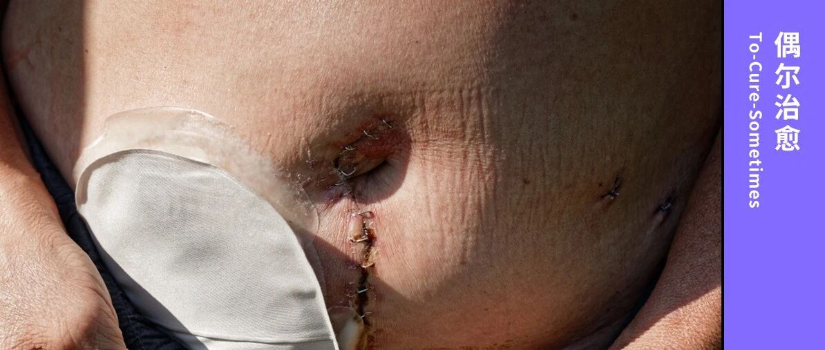 患癌父亲戴上「人工肛门」，我为他做的选择错了吗？