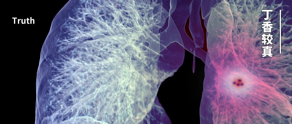 体检查出结节，会变成癌症么？一文给你讲清楚
