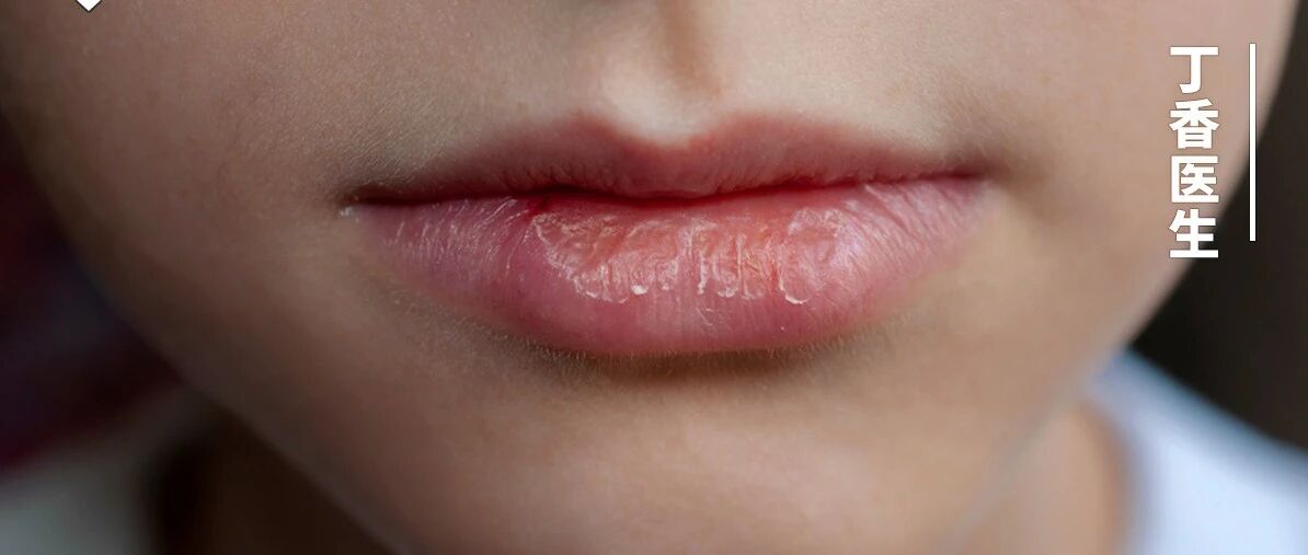 摆脱唇部「干旱」，这个神仙好物你一定得知道！
