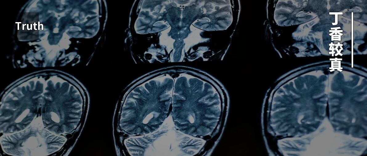 体检查出囊肿，会变成癌么？要切除么？一文给你说清楚