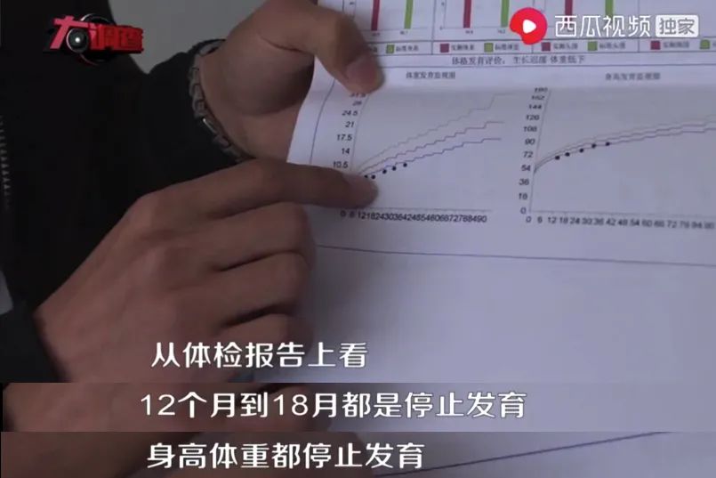 起紅疹、佝僂病、發育停止...湖南出現多名大頭娃娃 只因喝了這款「毒奶粉」 親子 第5張