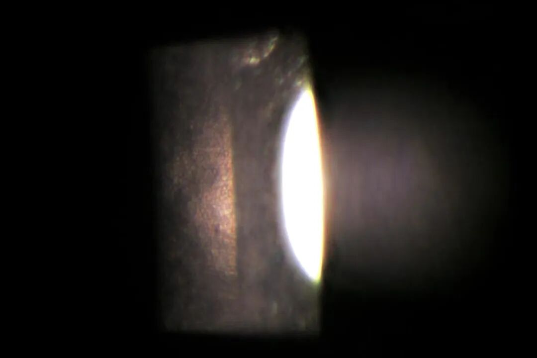 裂隙灯上光源是什么裂隙灯显微镜常用检查方法_https://www.jmylbn.com_新闻资讯_第10张