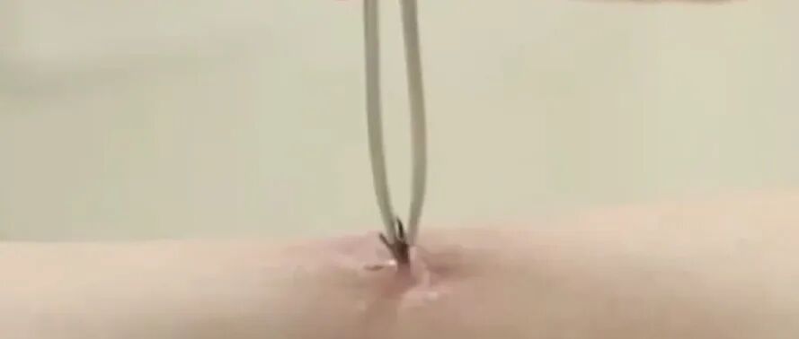 文章封面