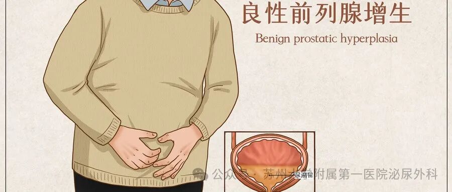 为什么要引流尿袋前列腺增生保留导尿——不要慌，看这里_https://www.jmylbn.com_新闻资讯_第1张