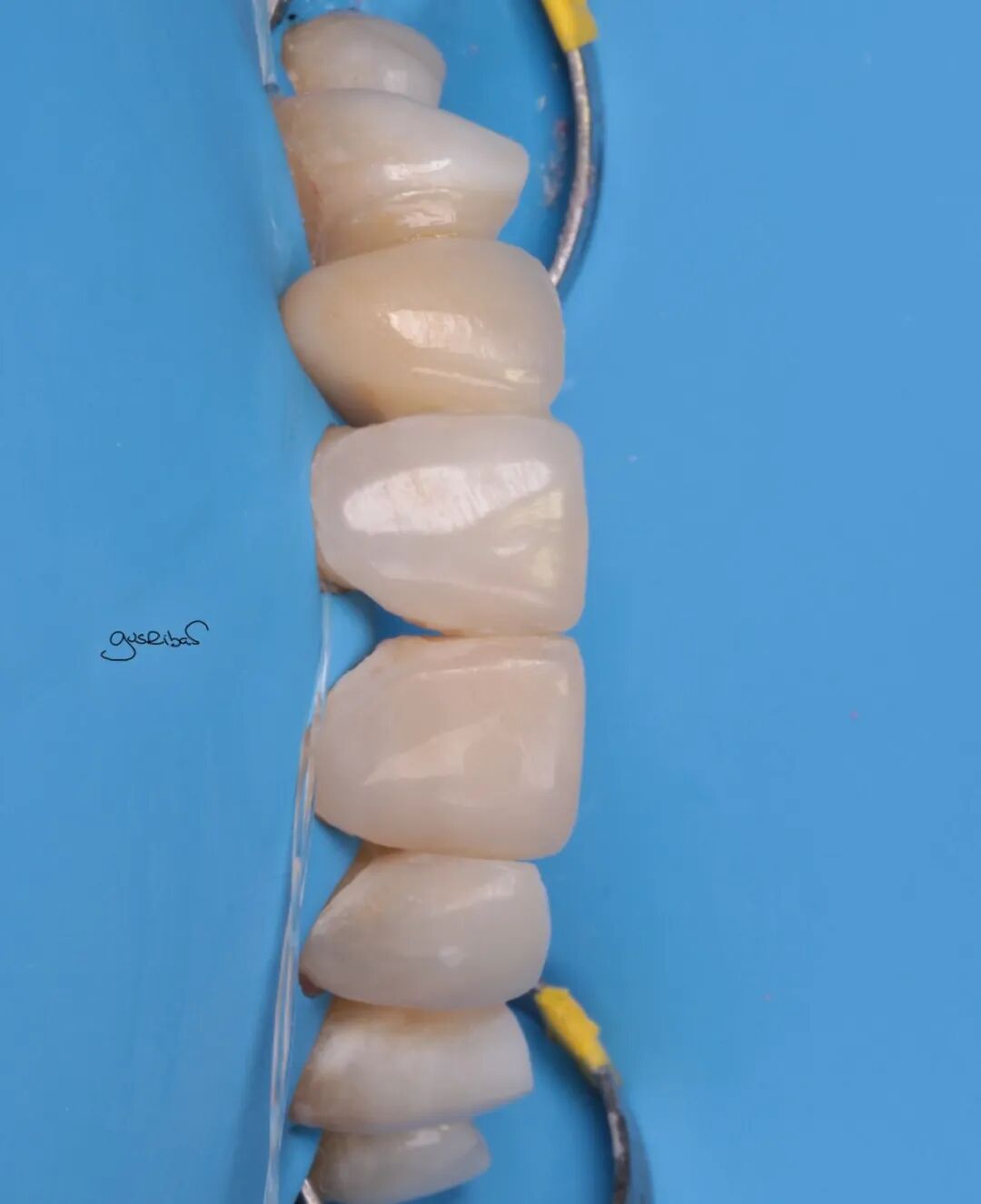 看个马里兰桥修复，感觉好复杂