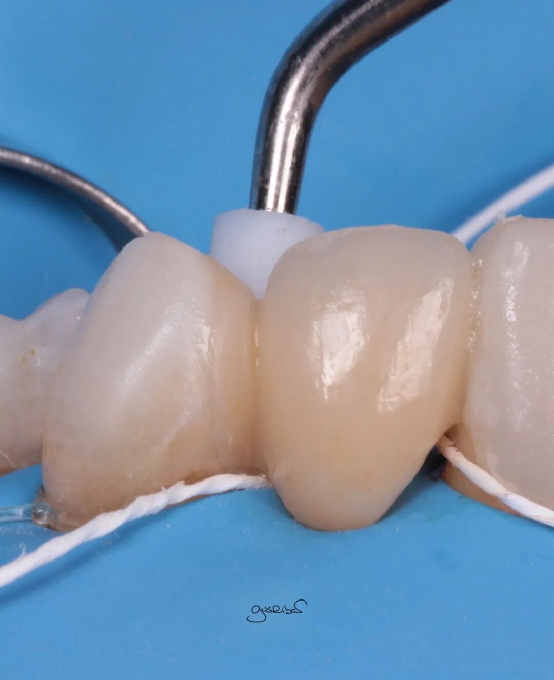 看个马里兰桥修复，感觉好复杂