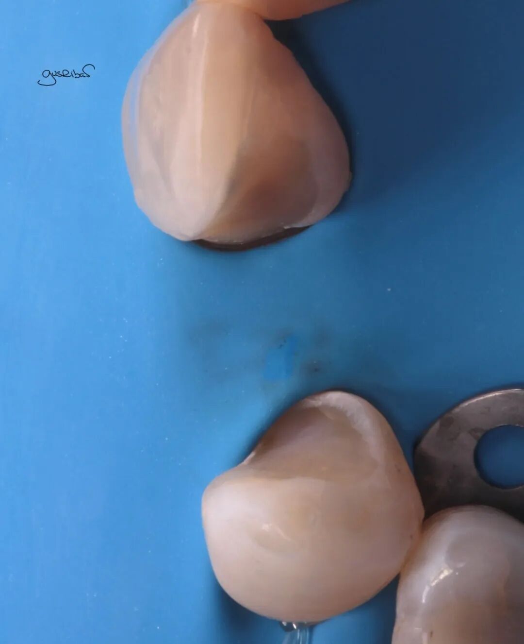 看个马里兰桥修复，感觉好复杂