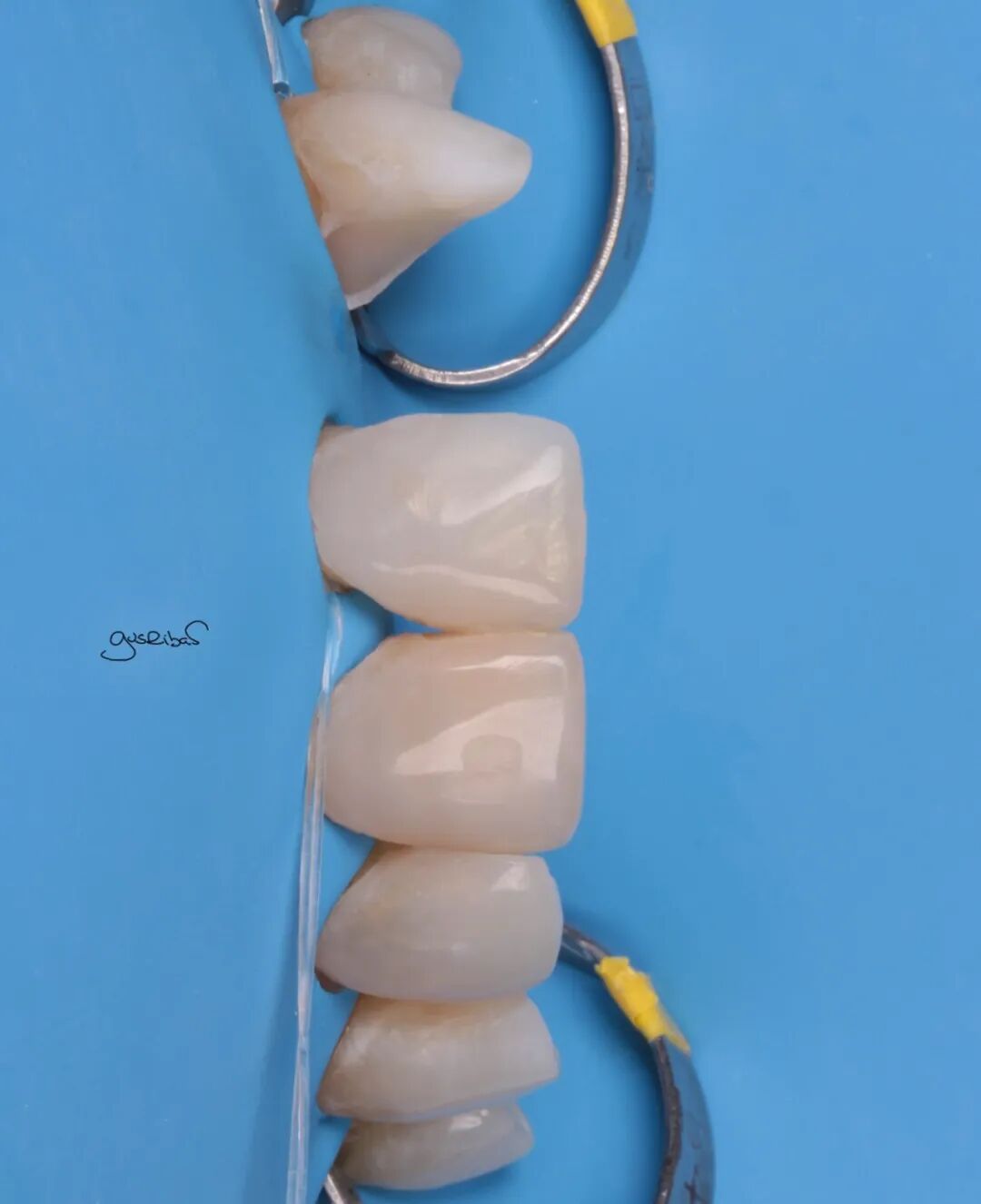 看个马里兰桥修复，感觉好复杂