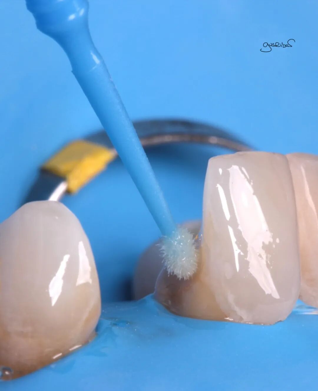 看个马里兰桥修复，感觉好复杂