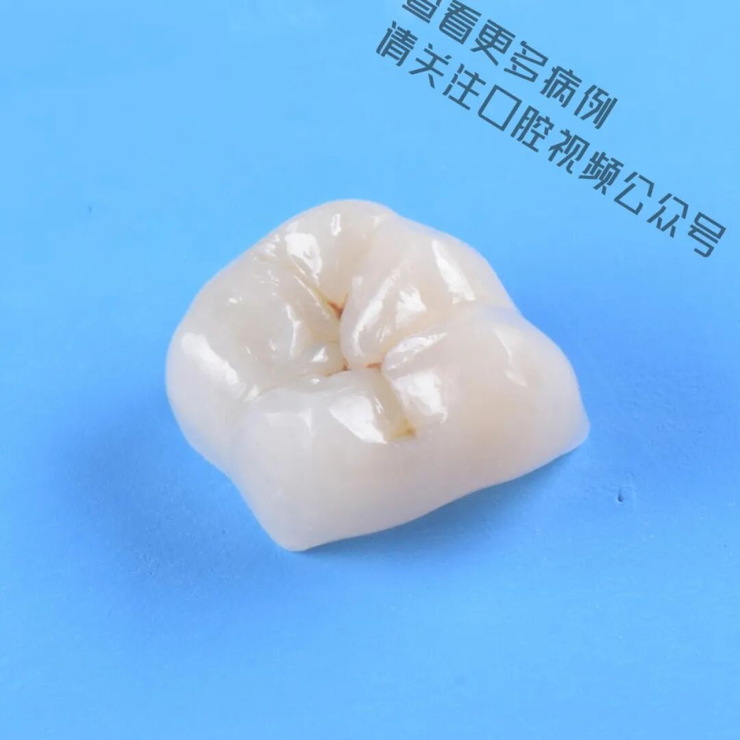 一颗濒临拔除的患牙，仿生学来修复它