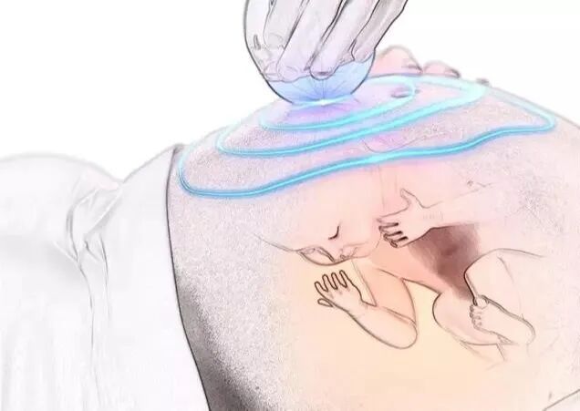 什么是超声容积探头【产检攻略】四维彩超检查，您了解多少？_https://www.jmylbn.com_新闻资讯_第16张