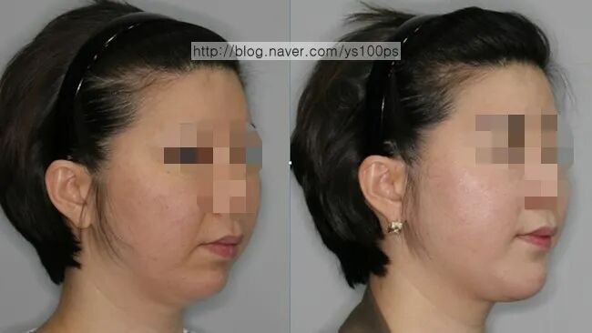 呼吸机怎么换氧气呼吸机里出来的是氧气吗？_https://www.jmylbn.com_新闻资讯_第3张