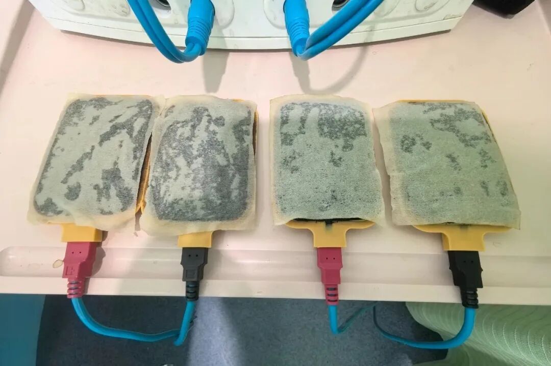 电脑中频药透用什么药【古法记忆】特色疗法——中频药透疗法_https://www.jmylbn.com_新闻资讯_第14张