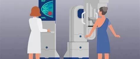 乳腺癌初筛年龄提前可降低死亡率