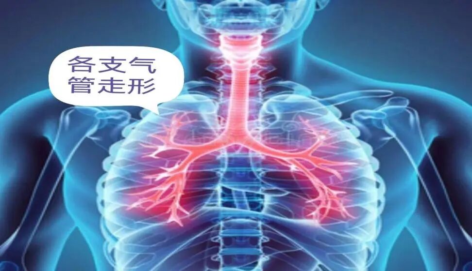 怎么给病人吸痰吸痰的那些事_https://www.jmylbn.com_新闻资讯_第6张