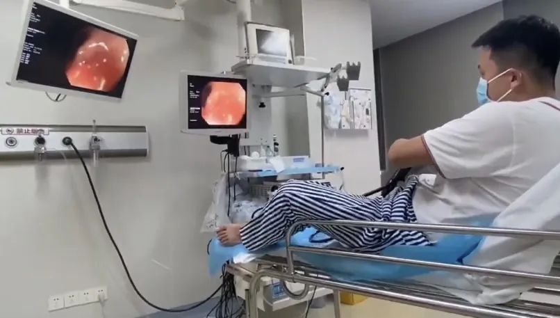 太拼了！广州医生无麻醉给自己做胃肠镜，为患者总结五点建议