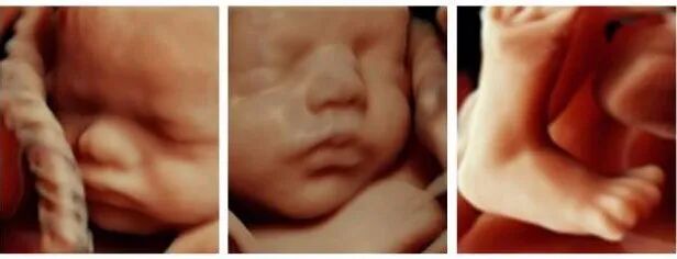 VOlusonE什么彩超机「升级」“金标版”GE Voluson E10四维彩超——从高清到高精，每一帧都是爱与期待的模样_https://www.jmylbn.com_新闻资讯_第7张