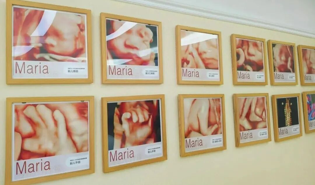 VOlusonE什么彩超机「升级」“金标版”GE Voluson E10四维彩超——从高清到高精，每一帧都是爱与期待的模样_https://www.jmylbn.com_新闻资讯_第2张