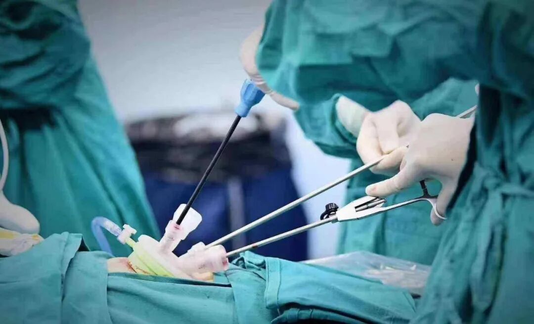 气腹管怎么接麻醉小白入门 ｜ 微创手术不得不提的术中气腹管理_https://www.jmylbn.com_新闻资讯_第1张