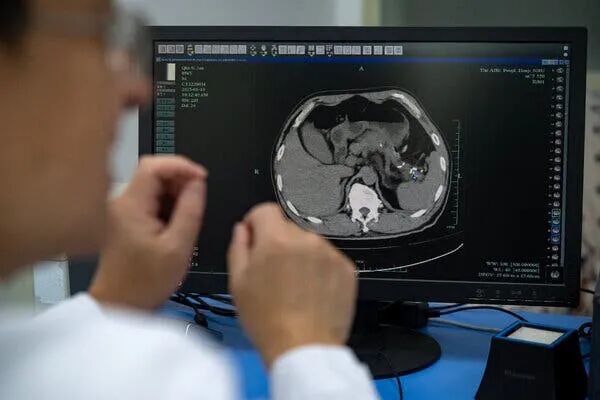 A computer monitor displays a medical scan of an abdomen. A person, seen from behind, observes the screen.