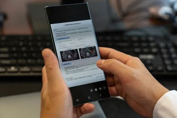 A person's hands hold a smartphone, showing medical text and two CT scans. One scan features green, red, and orange highlighted areas. A dark keyboard is blurred behind.