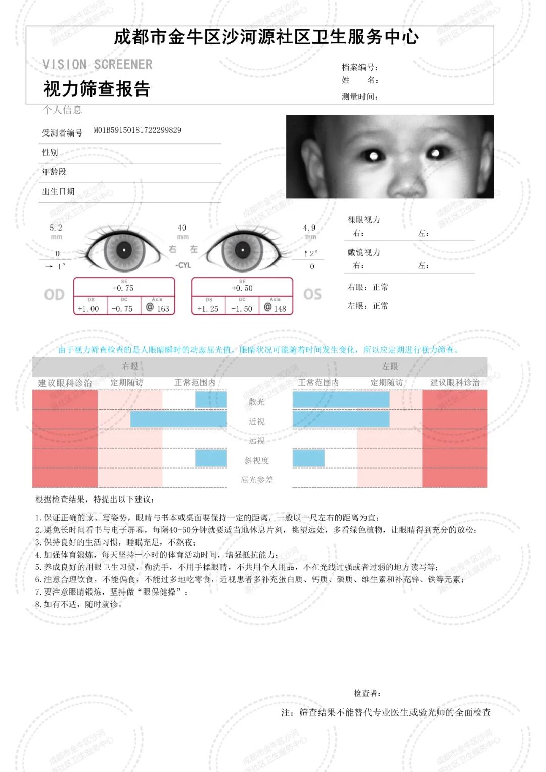 手持视力筛查仪怎么用告别烦恼！宝宝不配合眼科检查？双目视力筛查仪让您轻松应对！_https://www.jmylbn.com_新闻资讯_第14张