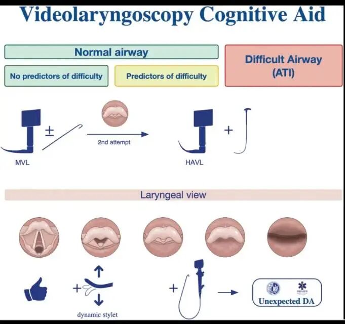 喉镜镜片怎么选插管用可视喉镜——国际气道专家小组指南_https://www.jmylbn.com_新闻资讯_第9张