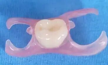 口腔种植手术包怎么打7月2日，北京种植牙专家谭包生教授将来到包医二附院坐诊、手术_https://www.jmylbn.com_新闻资讯_第15张