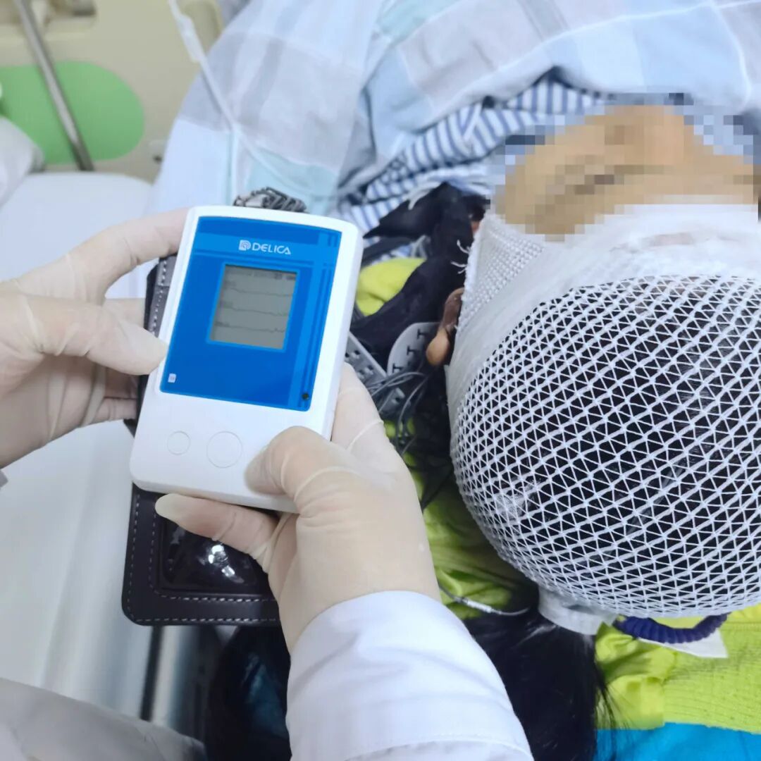 动态脑电图怎么看癫痫诊断出新招——动态脑电图_https://www.jmylbn.com_新闻资讯_第5张