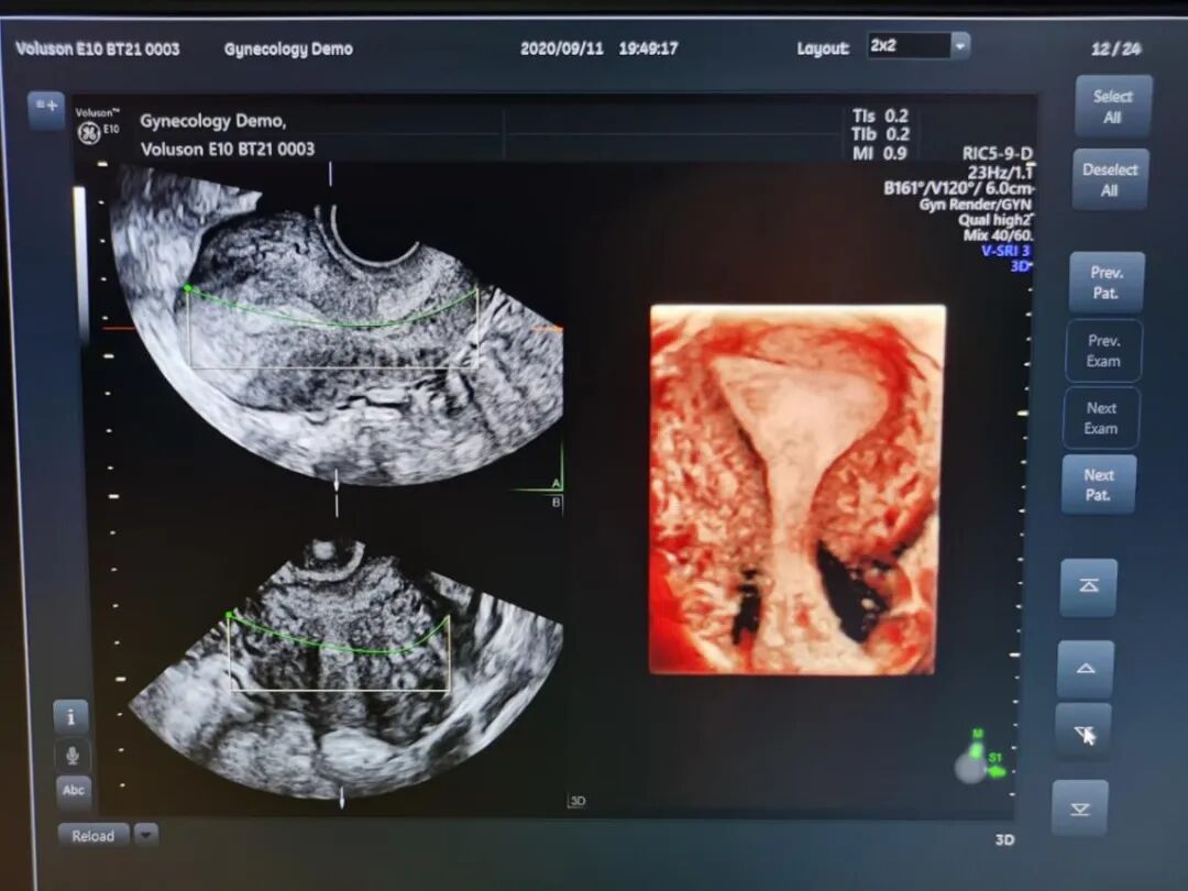 VOlusonE什么彩超机【重磅消息】准妈妈的福音！美国GE Voluson E10彩超进驻柳州二空医院啦！_https://www.jmylbn.com_新闻资讯_第12张