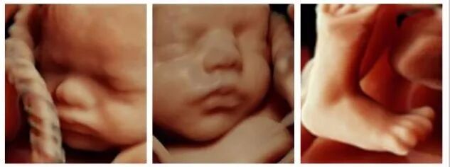 VOlusonE什么彩超机【重磅消息】准妈妈的福音！美国GE Voluson E10彩超进驻柳州二空医院啦！_https://www.jmylbn.com_新闻资讯_第7张