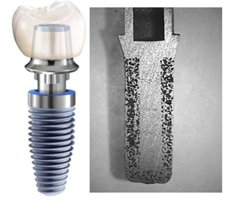 金属与工艺的完美结合：微型金属注射成型带来的新机遇的图3