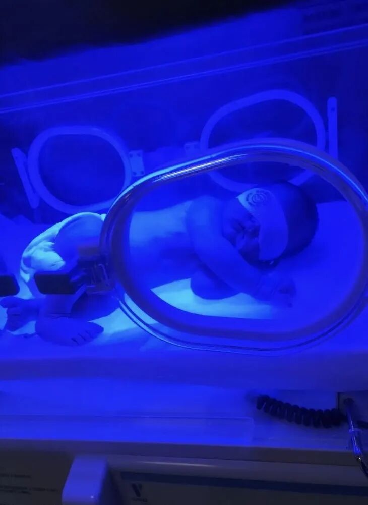 光疗时为什么黑眼罩科普 ｜ 关于光疗那些事_https://www.jmylbn.com_新闻资讯_第9张