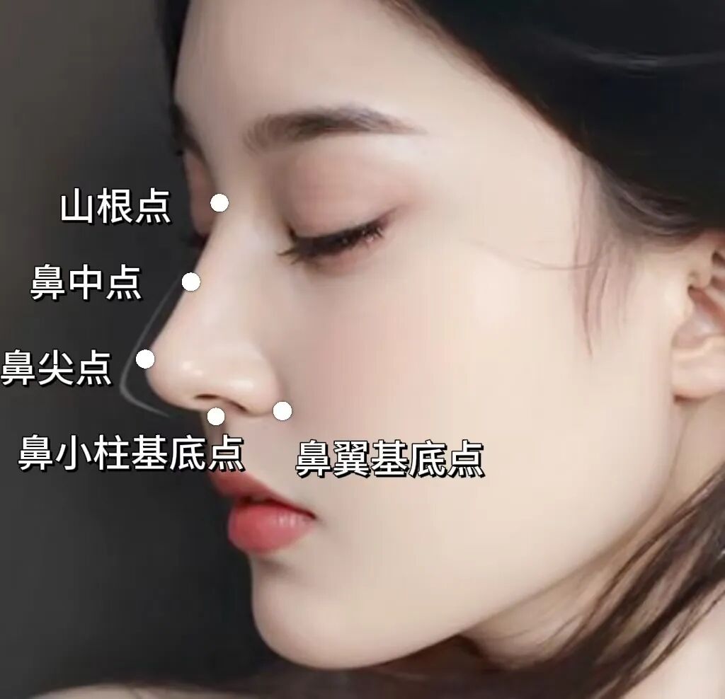 再凹的側臉也能變神顏——杏林改臉型