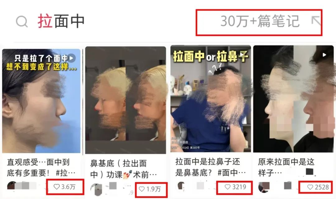 再凹的側臉也能變神顏——杏林改臉型